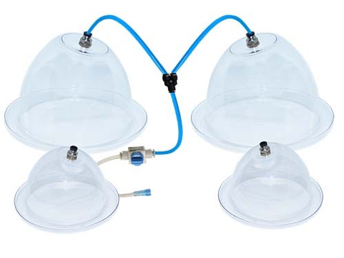 Vacumterapia Equipo 4 Copas Xl L Para Gluteos Busto Abdomen