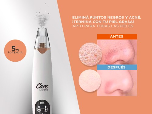 Limpiador Facial Removedor de Puntos Negros Gadnic Recargable