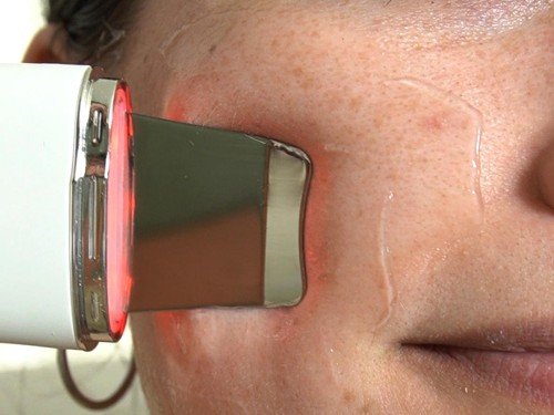 Espátula ultrasónica, peeling ultrasónico facial, EMS, terapia LED